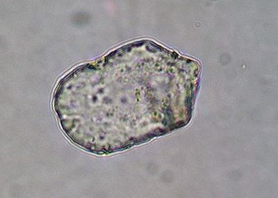 Microphotograph of a phytolith